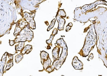 ADAMTS5 Antibody