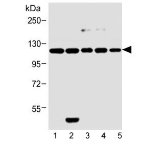 Insulin receptor-related Antibody (INSRR)