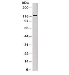 Western blot testing of human A431 cell lysate with P-Cadherin antibody (clone 6A9). Expected molecu