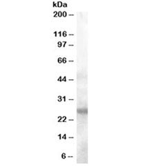 Western blot testing of human tonsil lysate with AID antibody at 0.1ug/ml. Predicted molecular weigh