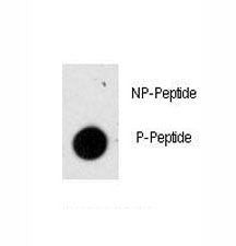 GFAP Antibody (phospho-S8)