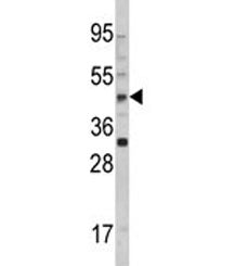 AADAC Antibody
