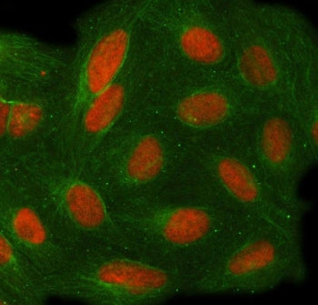 Immunofluorescent staining of FFPE human U-2 OS cells with Target of EGR1 protein 1 antibody (red) a