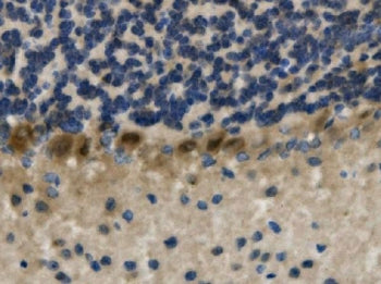 IHC staining of FFPE mouse brain with LIM-1 antibody. HIER: boil tissue sections in pH8 EDTA for 20 