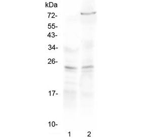 Western blot testing of 1) rat kidney and 2) mouse NIH3T3 lysate with TIMP3 antibody at 0.5ug/ml. Pr