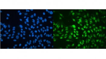 MBD4 Antibody