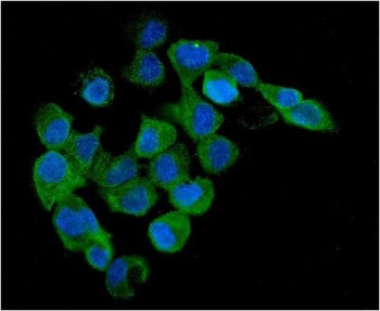 AMPK beta 1 Antibody / PRKAB1