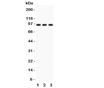 Western blot testing of TBK1 antibody and Lane 1: HeLa; 2: rat testis; 3: rat liver; Predicted molec