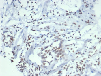 SULT1E1 Antibody / Estrogen Sulfotransferase