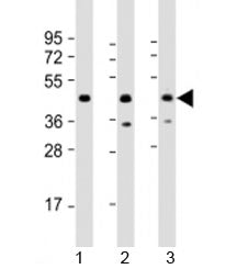 PHF6 Antibody / PHD finger protein 6