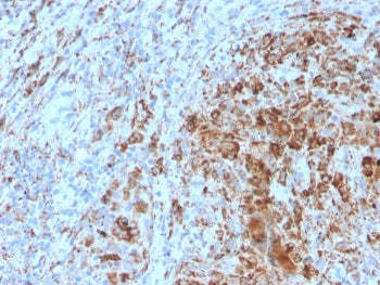 IHC staining of FFPE human lymph node with TIM3 antibody. HIER: boil tissue sections in pH 9 10mM Tr