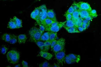PCK2 Antibody / PEPCK2