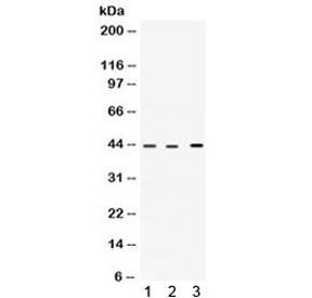 Western blot testing of 1) rat heart, 2) human HepG2 and 3) human A549 lysate with VEGFD antibody. E