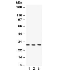 Western blot testing of 1) rat heart, 2) rat brain and 3) human A549 lysate with DKK2 antibody. Expe