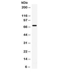 Western blot testing of human 22RV1 cell lysate with IL7R antibody. Predicted molecular weight: ~51/