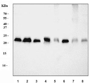 Western blot testing of 1) rat liver, 2) rat brain, 3) rat small intestine, 4) rat RH35, 5) mouse li