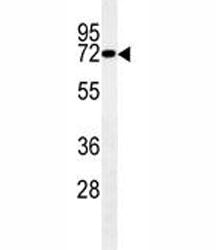 LIMK1 Antibody