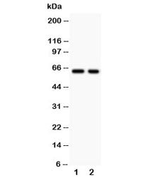 TGFBR2 Antibody