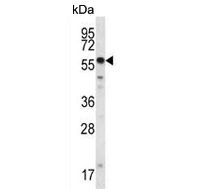 SMYD2 Antibody / KMT3C