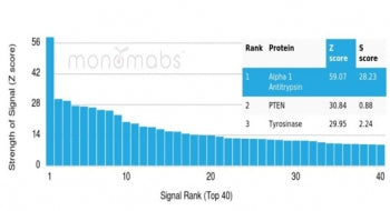 Alpha 1 Antitrypsin Antibody / AAT / SERPINA1