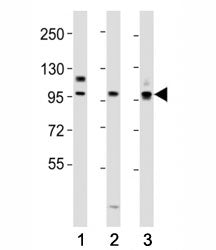 Western blot testing of PROX1 antibody at 1:2000 dilution. Lane 1: HepG2 lysate; 2: mouse liver lysa