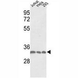 PCNA Antibody, 0.4ml