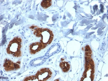Cytokeratin 3 Antibody / KRT3