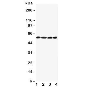 Western blot testing of IRF5 antibody and Lane 1: human placenta; 2: rat thymus; 3: (r) kidney; 4: (
