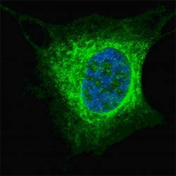 Vimentin Antibody, 0.08ml