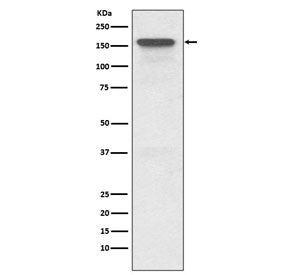 P Glycoprotein Antibody / MDR1 / ABCB1