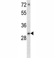 ATF5 Antibody