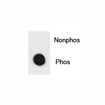 Phospho-IKK beta Antibody (pS733)
