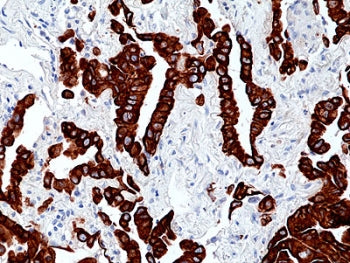 Keratin 7 Antibody / KRT7 / Cytokeratin 7