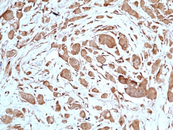 Recombinant STAT3 Antibody