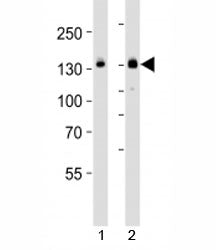 Western blot analysis of lysate from HT-29 cell line and mouse spleen tissue lysate (left to right) 