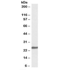 Western blot testing of KELLY cell lysate with Neuroblastoma antibody at 0.1ug/ml. Predicted molecul