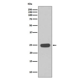 Western blot testing of human Jurkat cell lysate with Interferon gamma antibody. Expected molecular 