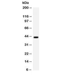 Western blot testing of human Jurkat lysate with Cdk9 antibody. Predicted/observed molecular weight 