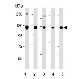 ROR2 Antibody