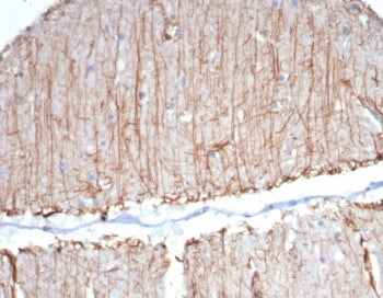 IHC staining of FFPE human brain tissue with GFAP antibody (clone GFAP/6874). HIER: boil tissue sect