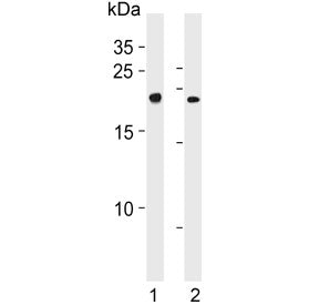 CBFB Antibody