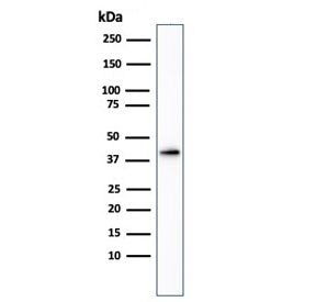 Western blot testing of human kidney tissue lysate using AMACR antibody. Predicted molecular weight 