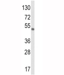 VEGFC Antibody