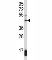 SUV39H1 Antibody