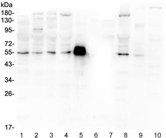 Western blot testing of human 1) PC-3, 2) U-2 OS, 3) A549, 4) HEK293, 5) rabbit IgG, 6) marker, 7) h