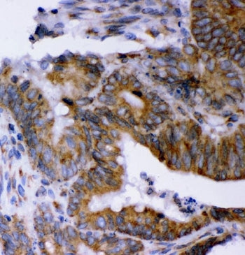 AEG-1 Antibody / Astrocyte elevated gene-1 / MTDH / LYRIC