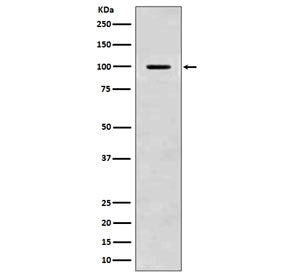 Amyloid beta Antibody / APP