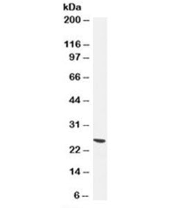 Western blot testing of human brain lysate with UchL1 antibody (clone 13C4). Predicted molecular wei