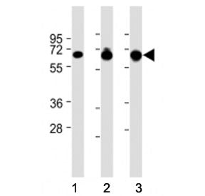Western blot testing of GLAST antibody at 1:8000: Lane 1) human brain, 2) mouse brain and 3) mouse c
