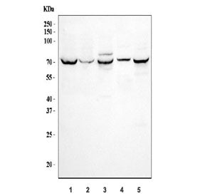 Western blot testing of 1) human HepG2, 2) human 293T, 3) rat kidney, 4) rat NRK and 5) mouse kidney